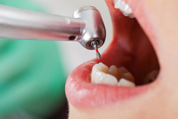 Best Emergency Treatment for Dental Infections or Abscesses in Yorkville, WI